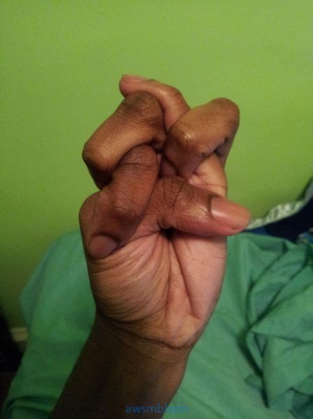 pics_day_awsmblssm01217